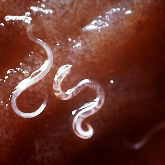 Hookworm Infection